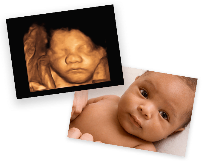 A montage of an ultrasound image and a baby photo.