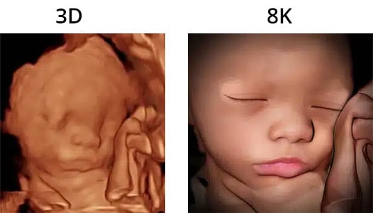 A comparison of 3D and 8K ultrasounds
